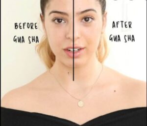 gua sha before and after