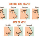 types of noses